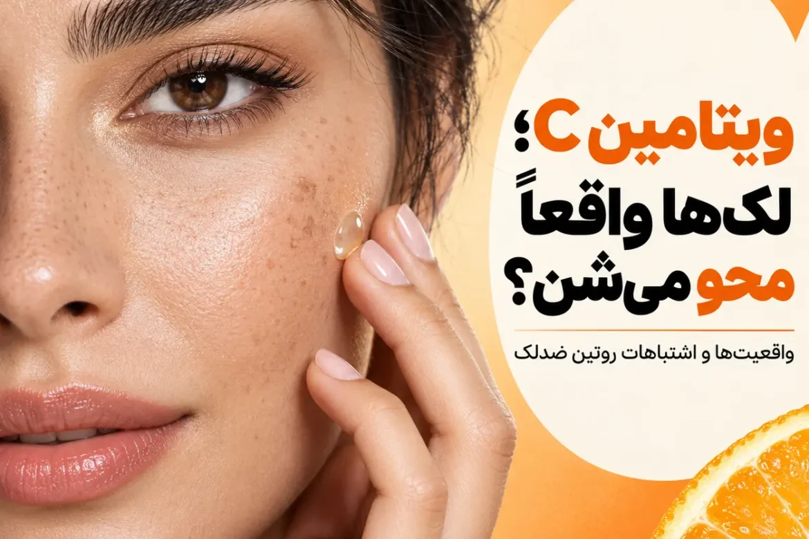 رفع لک پوست با ویتامین C